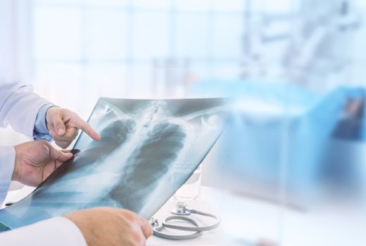 تشخیص گرانولوماتوز با پلی‌آنژیت از روی عکس قفسه سینه