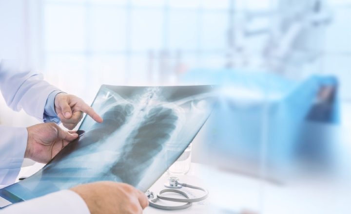 تشخیص گرانولوماتوز با پلی‌آنژیت از روی عکس قفسه سینه