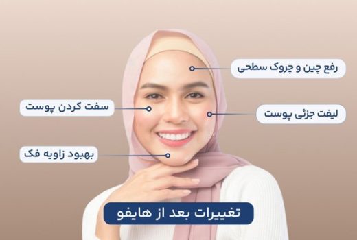بهترین مارک دستگاه هایفو