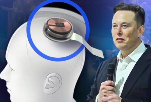 پیشرفت چشمگیر نورالینک در کاشت تراشه مغزی