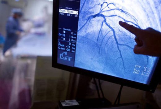 توسعه موفقیت‌آمیز لوله قلبی هوشمند با قابلیت تنظیم خودکار