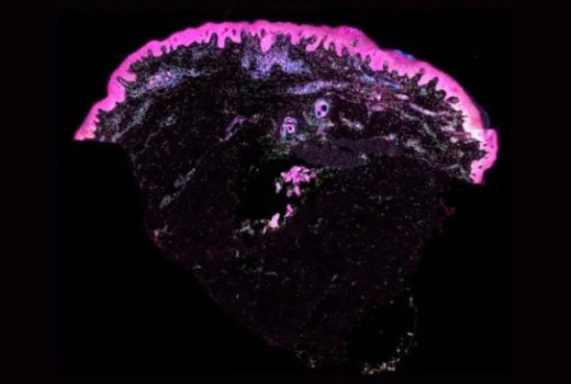 نقشه‌ای جامع از رشد پوست جنین و امیدهای تازه در پزشکی ترمیمی