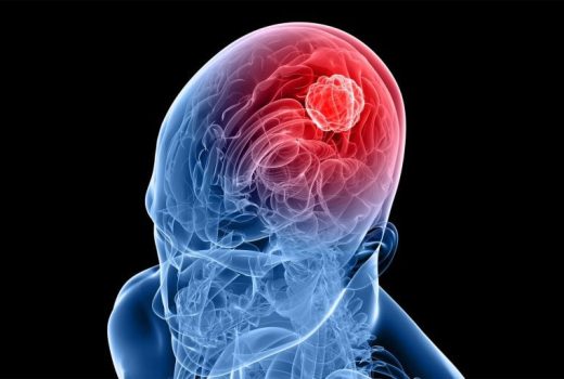 کشف امیدبخش برای درمان گلیوبلاستوما؛ قدرت پنهان در بنفشه‌ها