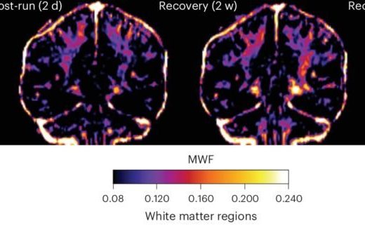 بافت چربی مغز