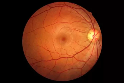 رگ‌های چشم شاید بتواند به تشخیص زودهنگام زوال عقل کمک کند