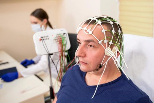 الکترود شبیه به مو